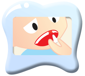 reinserting a knocked out tooth clipart